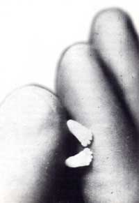 Fetal Feet